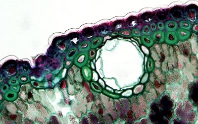 Stem Cells for Autoimmune Diseases
