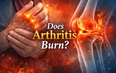 Does Arthritis Burn